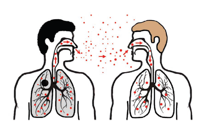 Periksa 1.055 Orang, 360 Positif TB