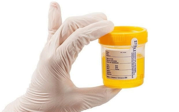 Polda Kepri Cek Urine Awak Kabin