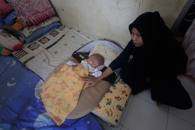 Gilang Andika, Bayi Kembar Siam Meninggal Dunia