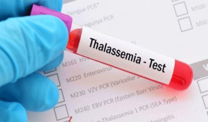 IDAI Kepri Catat 50 Anak Menderita Thalassemia