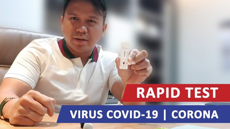 Osco Bakal Calon Wakil Wali Kota Batam jadi ODP, Ini Hasil Rapid Testnya