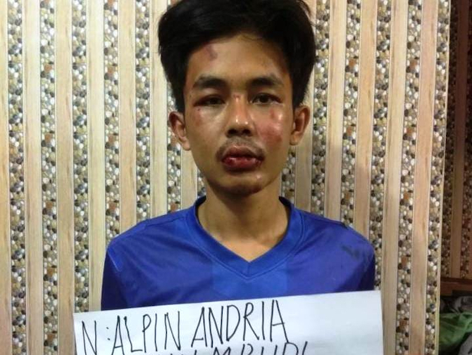 Tersangka Penikam Syekh Ali Jaber Dikenai Pasal Berlapis