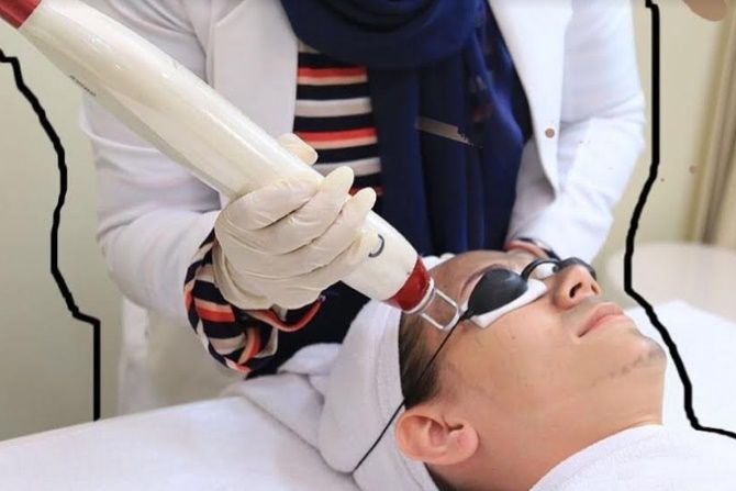 Terapi Laser Untuk Perawatan Kulit Hingga Hilangkan Tato