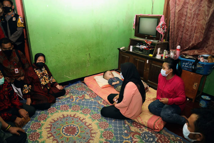 Lanjutkan Proses Pengobatan, Mensos Bawa Bocah Penderita Hidrosefalus ke Jakarta