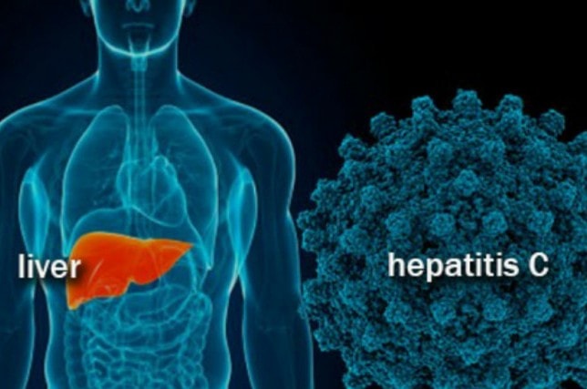 BPJS Kesehatan Tanggung Biaya Penanganan Anak Penderita Hepatitis