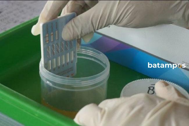 Apindo Buka Layanan Cek Urine Gratis