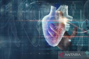 Penyakit Jantung masih Jadi Penyebab Kematian Utama, Perlu Penanganan dari Hulu dan Hilir