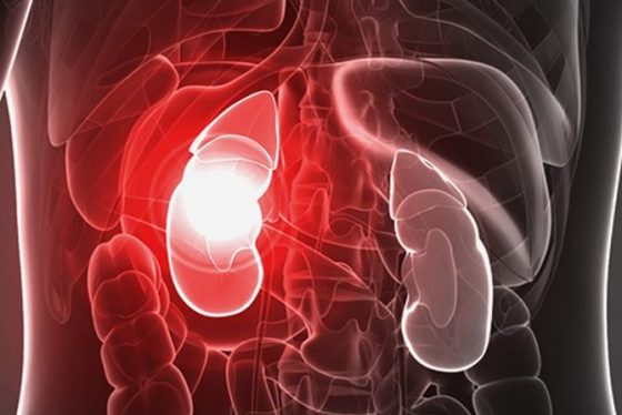 Cegah Ginjal Akut Terulang, DPR Bentuk Panja Soal Tata Kelola Farmasi