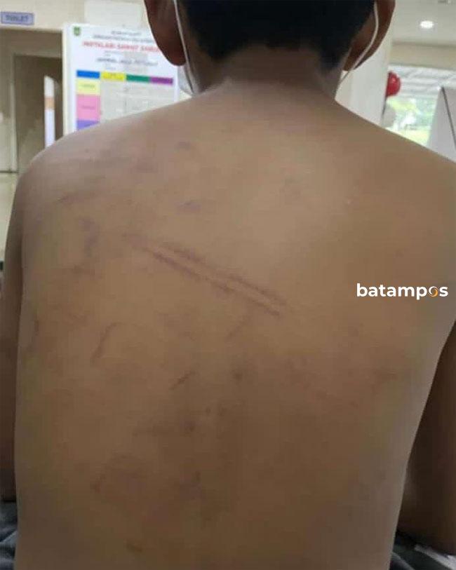 Polisi Selidiki Kasus Penganiayaan di Pondok Pesantren An’nimah Batam