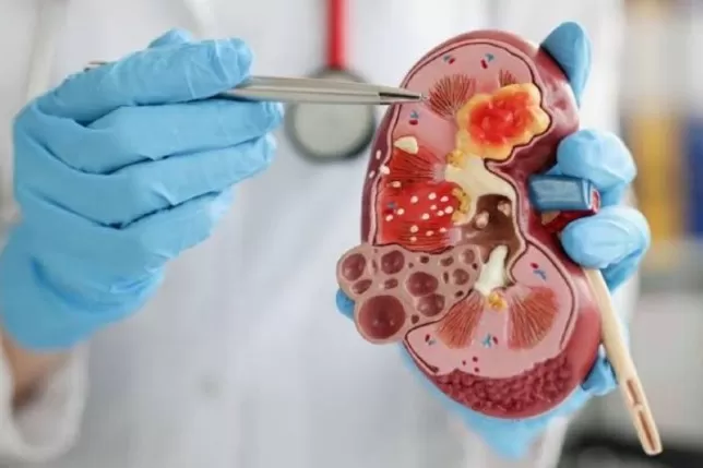 Guru Besar UGM Sebut Tak Ada Hasil Outopsi Sirup Paracetamol Penyebab Gagal Ginjal Akut Anak