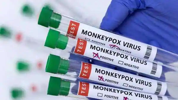 Monkey Pox Meningkat Pesat di Indonesia  
