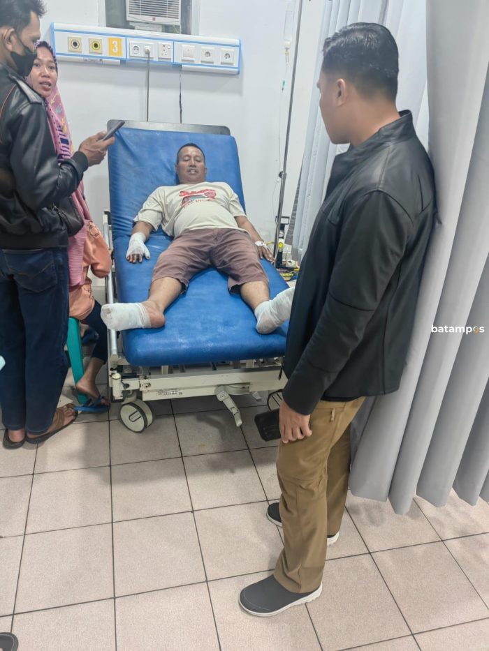Korban Luka Bakar Akibat Kesetrum Sudah Pulang dari RS