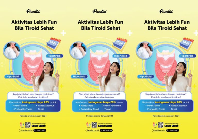 Jangan Biarkan Gangguan Tiroid, Ganggu Aktivitasmu