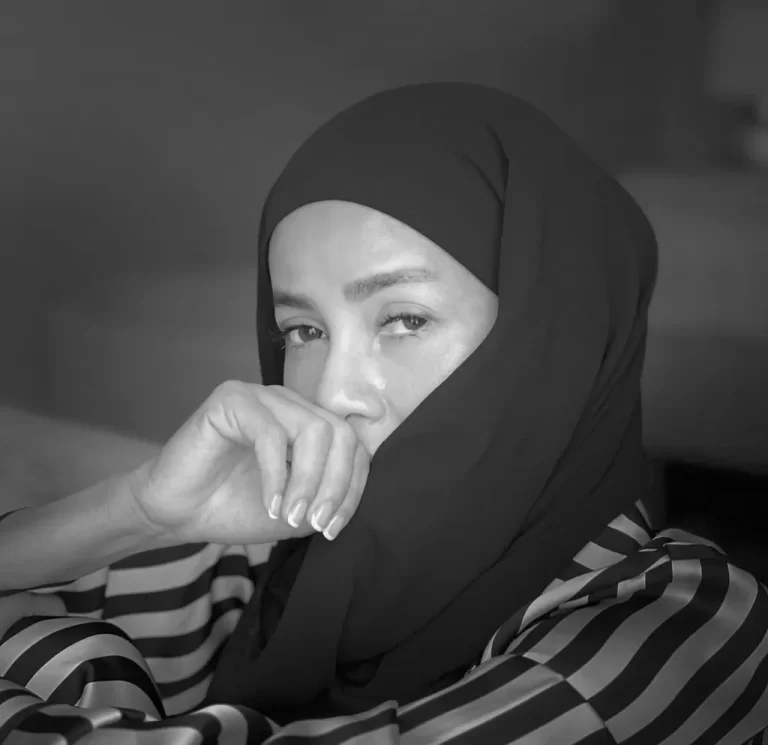 Olla Ramlan Idap Dermatitis Perioral, Tulis Pesan Minta Tolong