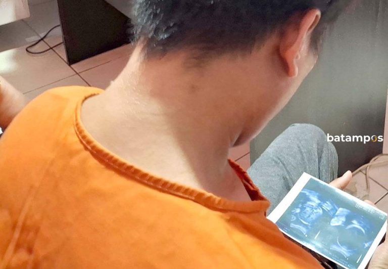 Ide Kebiri Muncul untuk Hukum Predator Remaja Putri