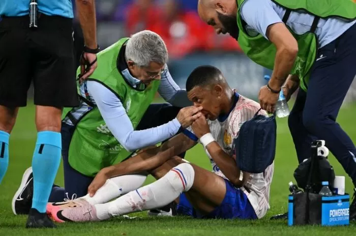 Kylian Mbappe Cedera Patah Tulang Hidung