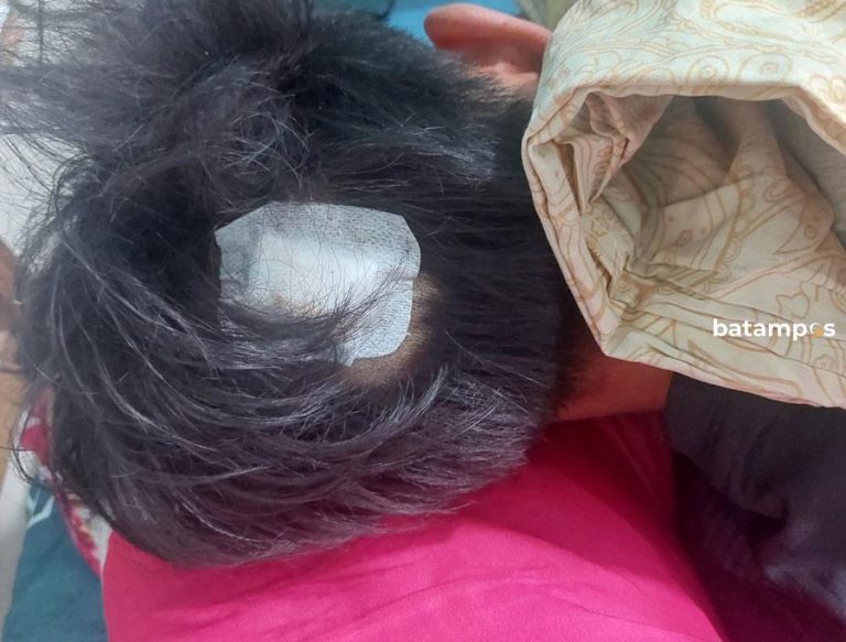 Polisi Bantah Foto yang Beredar Terkait Korban Begal di Temiang