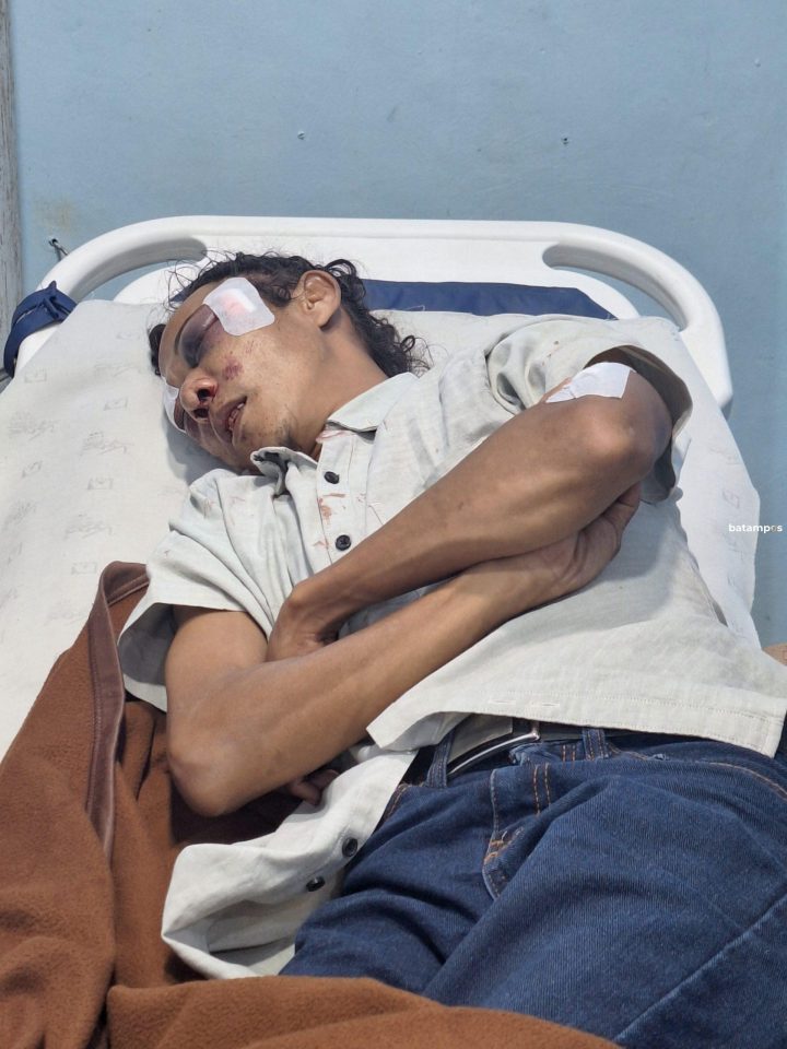 Diserang Orang Tak Dikenal, 10 Warga Rempang Luka-luka dan Minta Keadilan