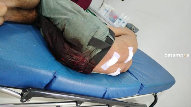 Karyawan Grosir di Sekupang Alami Tiga Luka Tusuk, Pelaku Ditangkap di Kos-kosan