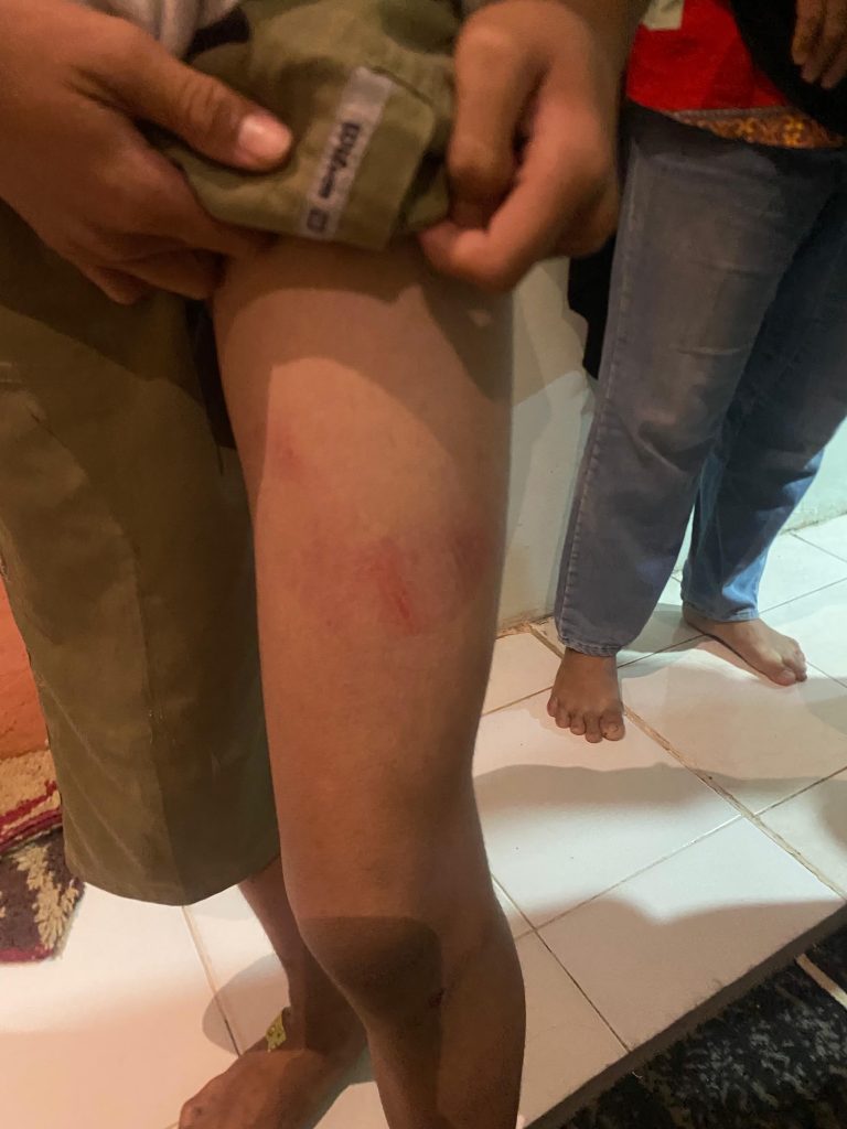 Polda Kepri Selidiki Kasus Penganiayaan Pelajar oleh Sekuriti Kawasan MB2