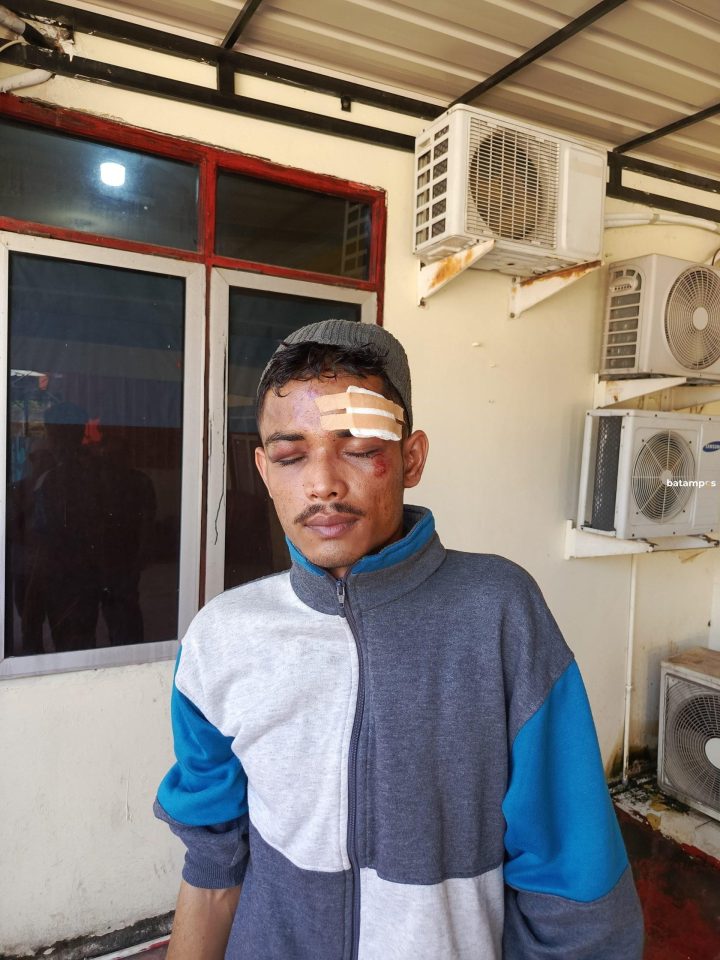 Karisma Babak Belur Dikeroyok di SP Plaza Sagulung