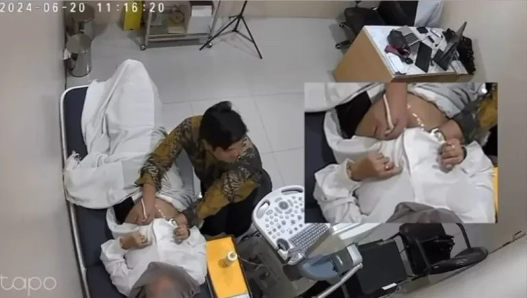 Dokter Obgyn Diduga Lakukan Pelecehan ke Pasien Saat Jalani USG Viral di Medsos