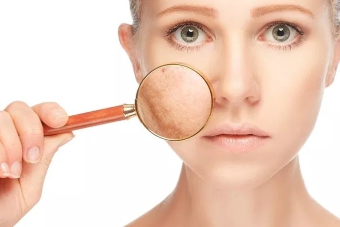 Penjelasan Medis Fase Luteal, Saat Perempuan Merasa ‘Jelek’ Sebelum Menstruasi