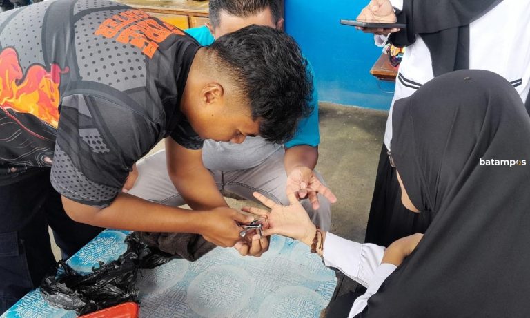 Cincin Pernikahan Tak Bisa Lepas, Guru di Bintan Minta Bantuan Tim Damkar