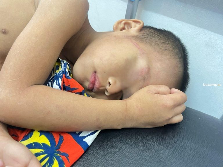 Ayah Tiri di Batam Resmi Jadi Tersangka Penganiayaan Anak, Korban Alami Luka Serius