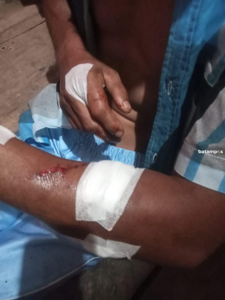 Warga Sei Ladi Tanjungpinang Diterkam Buaya 