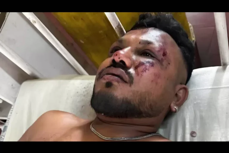Satu-Satunya Penumpang yang Selamat dari Kecelakaan Pesawat Air India, Ini Kesaksian Ramesh