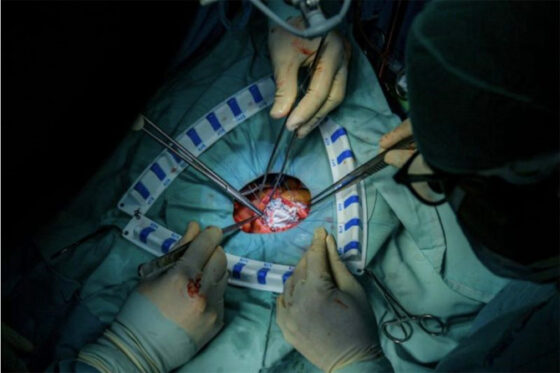 Pasien Indonesia Eksodus Berobat ke Luar Negeri, Gerus Devisa Ratusan Triliun