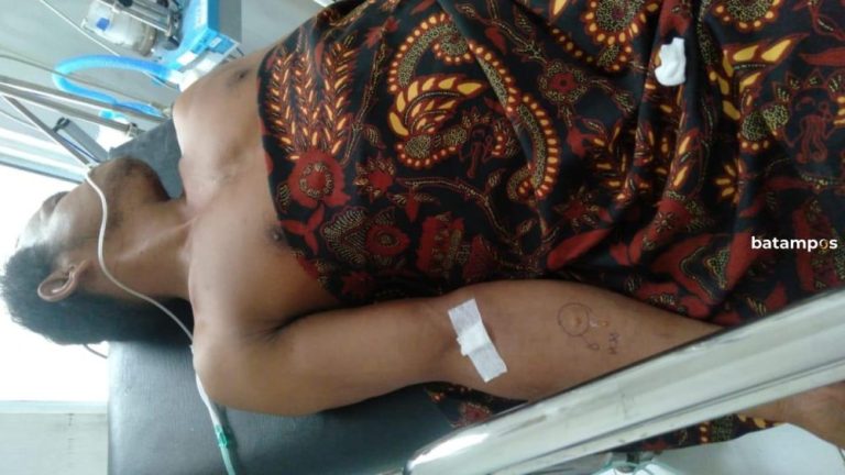 Nelayan Anambas Nyaris Tewas Ditabrak Speed Boat saat Cari Tiram