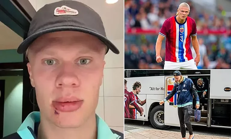 Erling Haaland Kecelakaan saat Bersama Timnas Norwegia