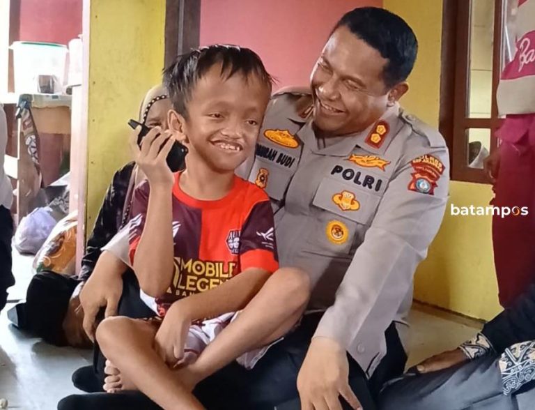 Kisah Haru Fajar, Bocah Pengidap Hidrosefalus yang Menyentuh Hati Kapolres Anambas