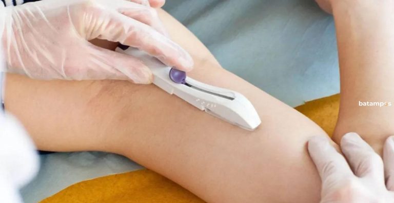 1.885 Warga Batam Ikut KB Jangka Panjang Sepanjang 2025