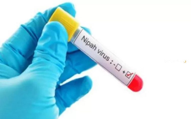 Antisipasi Virus Nipah, Pengawasan Kesehatan di Pintu Masuk Batam Diperkuat